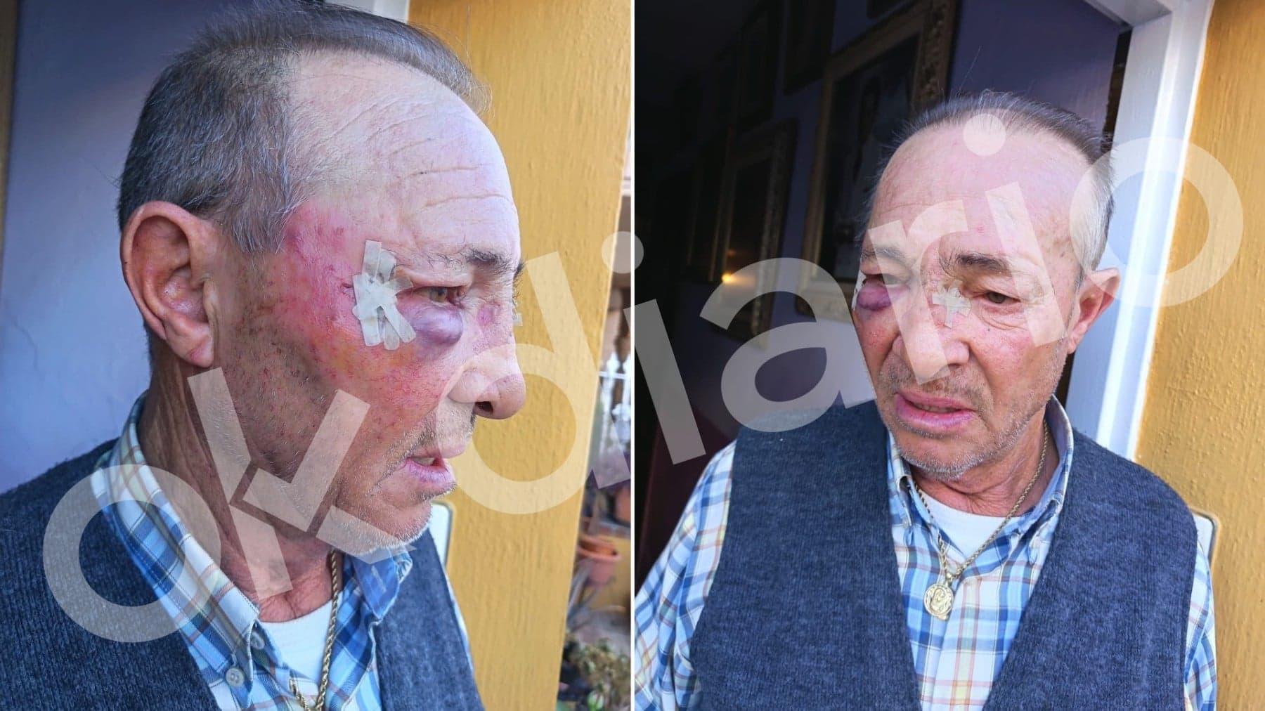Jóvenes magrebíes apalean a vecino discapacitado